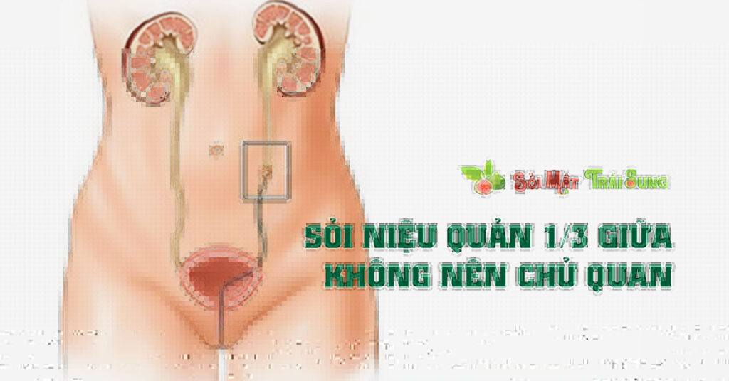 Sỏi Mật Trái Sung