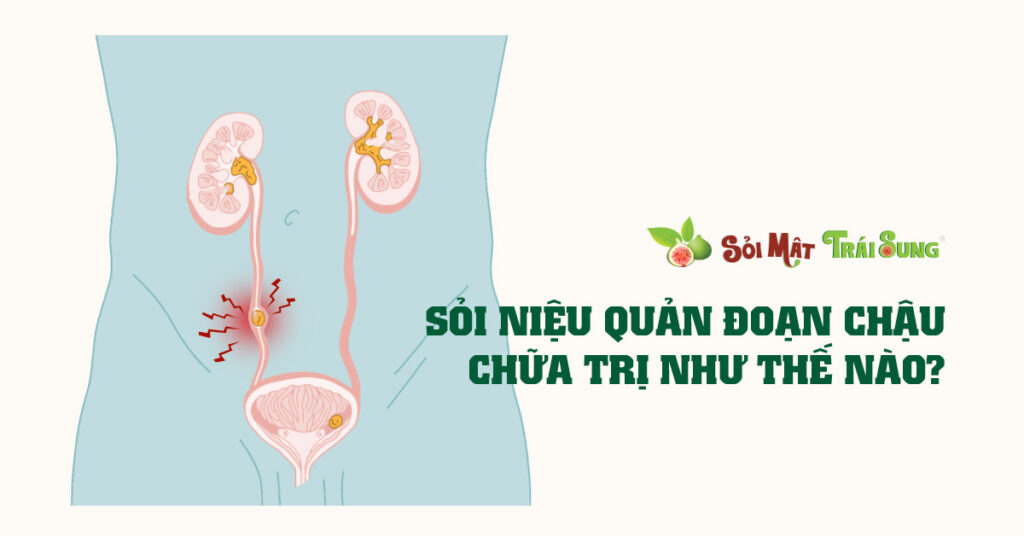Sỏi Mật Trái Sung