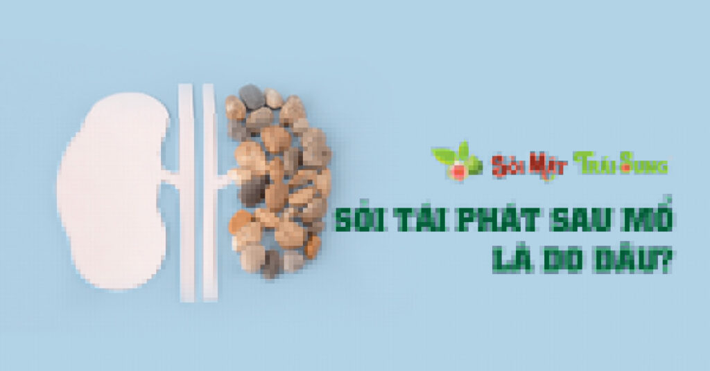 Sỏi Mật Trái Sung