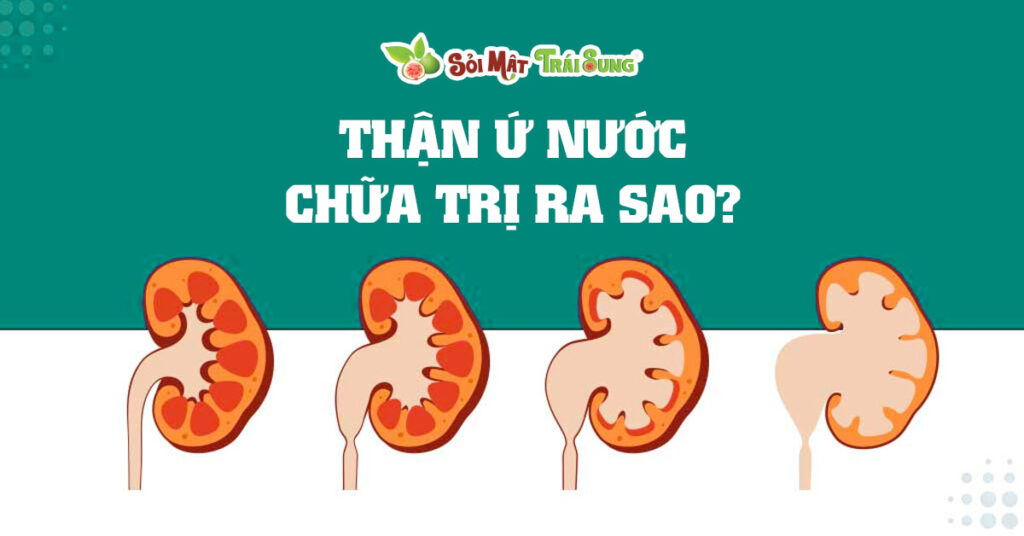 Sỏi Mật Trái Sung