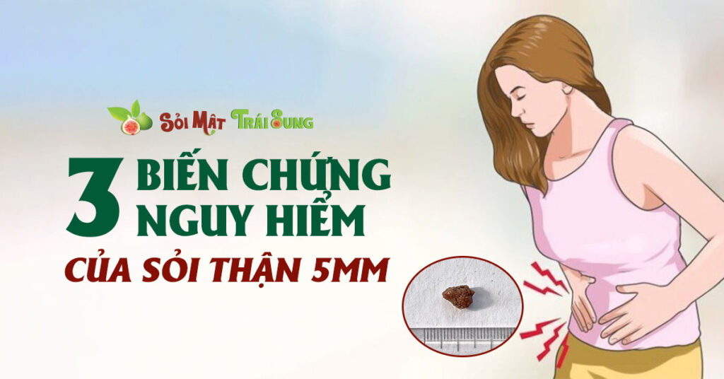 Sỏi Mật Trái Sung