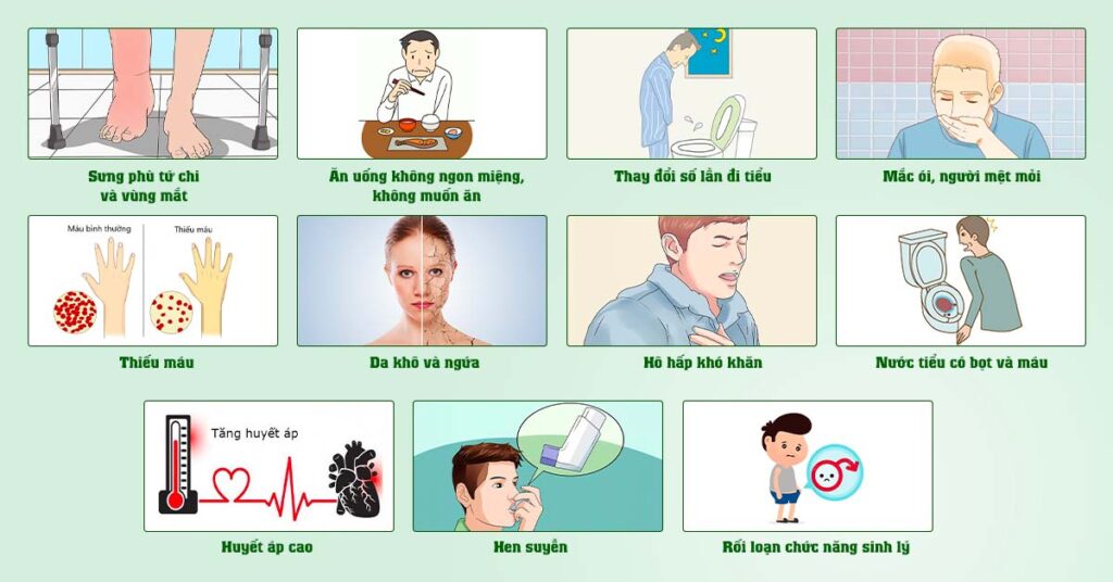 Sỏi Mật Trái Sung