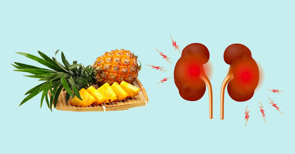 Sỏi Mật Trái Sung