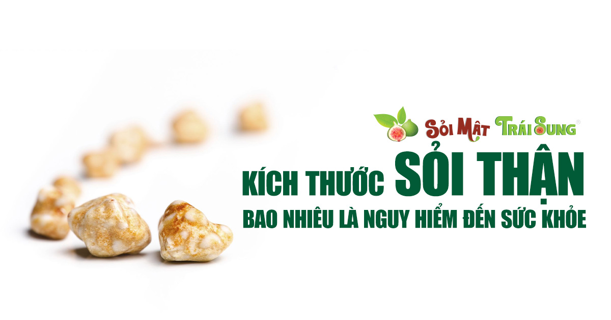 Kích thước sỏi thận bao nhiêu là nguy hiểm đến sức khoẻ?