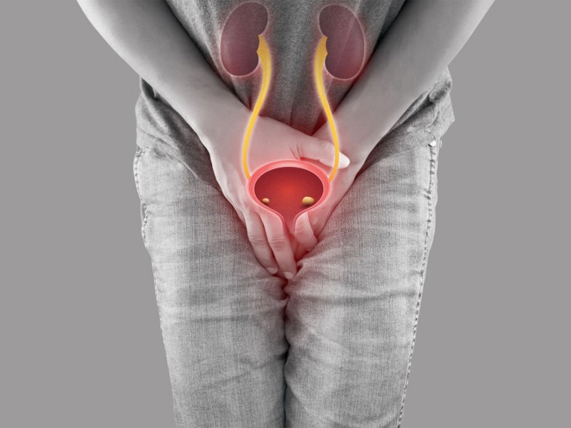 Mức độ nguy hiểm khi mắc sỏi bàng quang