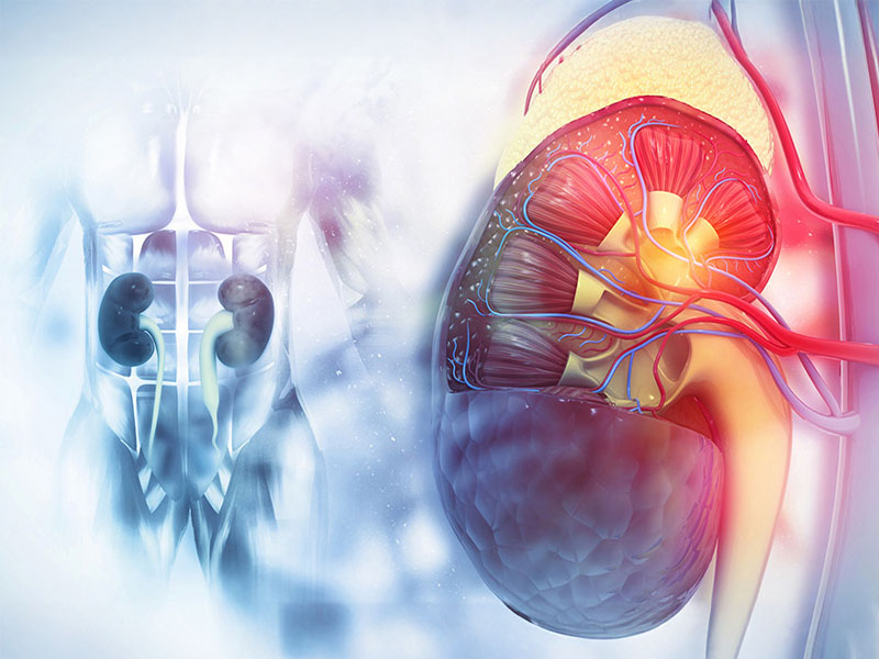  Sỏi thận phải ảnh hưởng trực tiếp đến hệ bài tiết của cơ thể