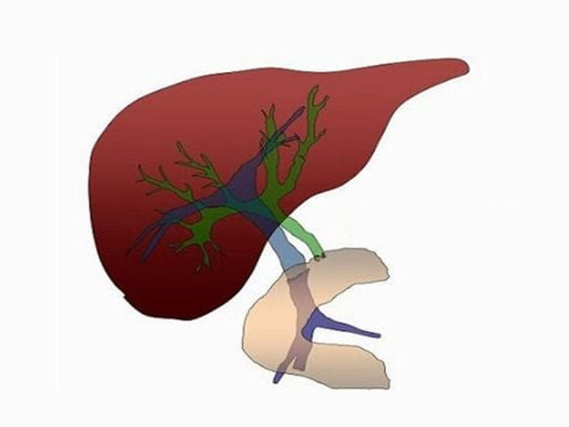 Đột biến nhiễm sắc thể thường và lặn đều gây nên bệnh giãn đường mật trong gan