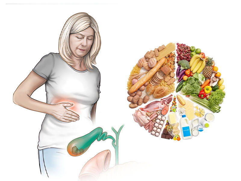 Chế độ dinh dưỡng hợp lý giúp ngừa sỏi mật hiệu quả