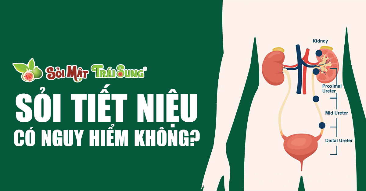 Sỏi tiết niệu có nguy hiểm không?