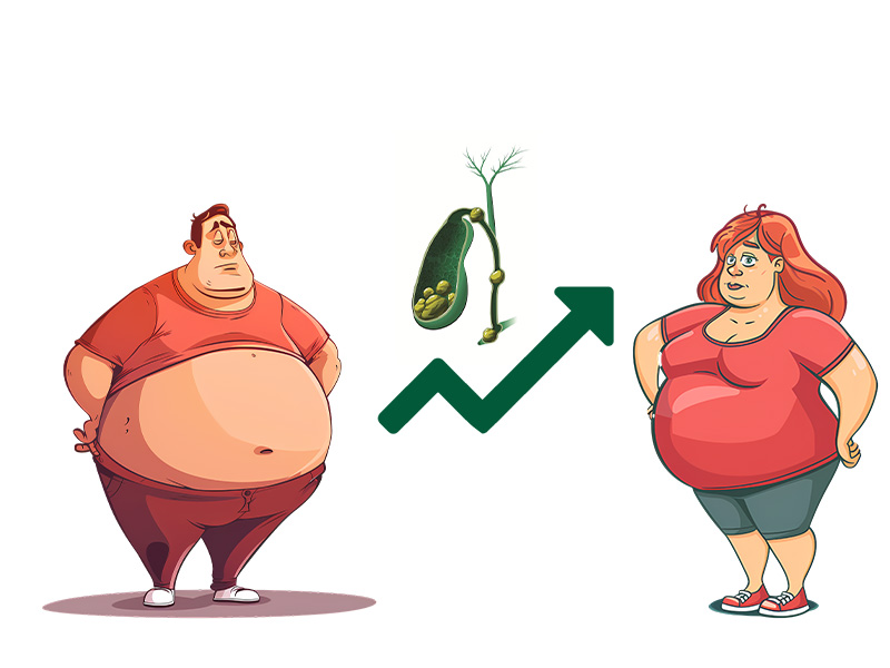 người béo phì mắc bệnh sỏi mậ