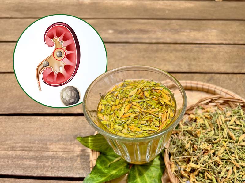 Trị sỏi thận bằng bông đu đủ đực hết không?