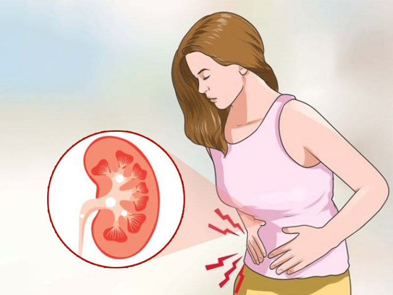 5 biểu hiện sỏi thận đau thường gặp