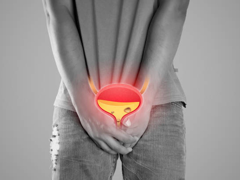 Sỏi bàng quang rớt xuống niệu đạo dễ dàng nếu sỏi có kích thước bé, tròn và nhẵn